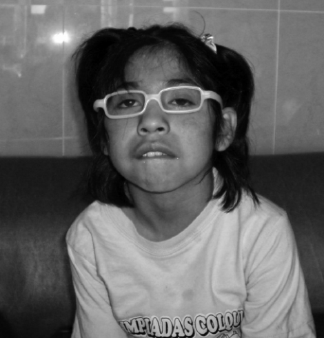 Blanca - Cerebral Palsy, Epilepsy