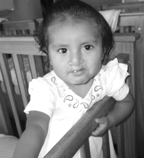 maria-cleft-lip-and-palate